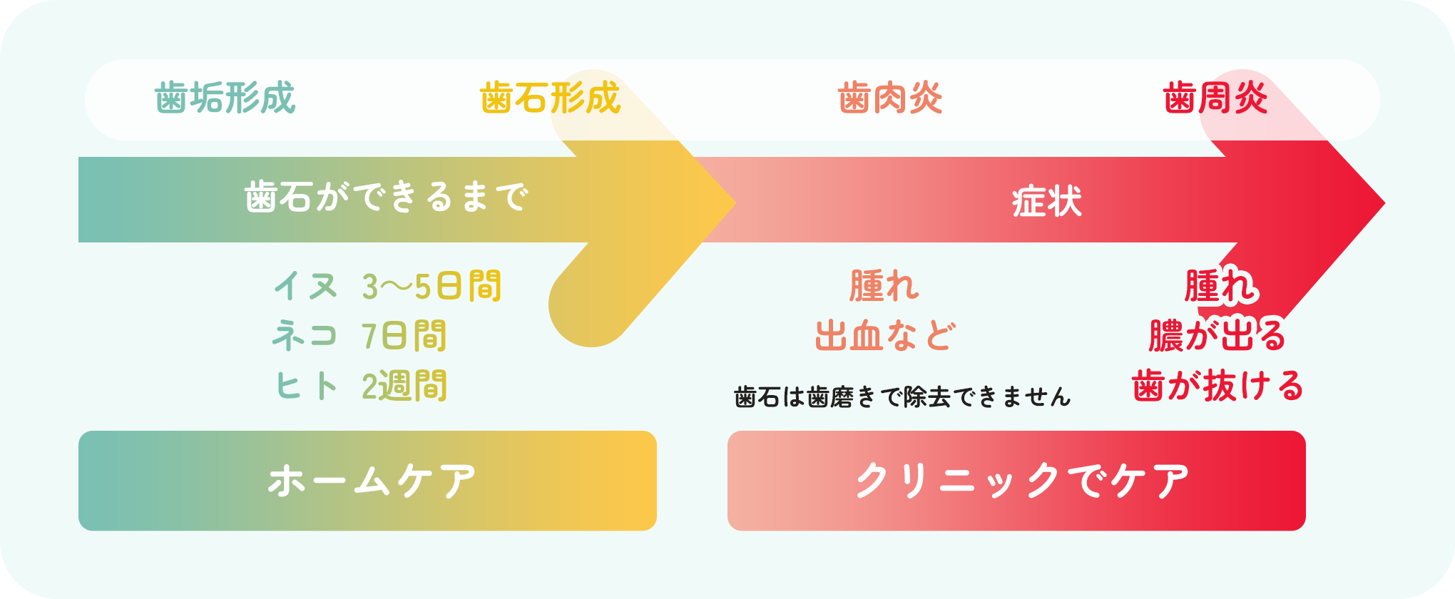 歯石ができるまでの解説図